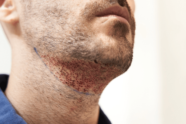 Ailthon Luiz Takishima